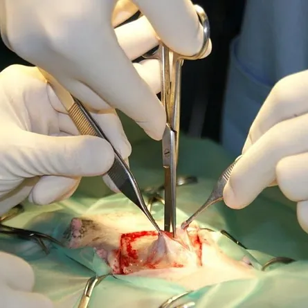 Operation